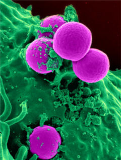 wb-198-11-is-antibiotic-resistance-evolution