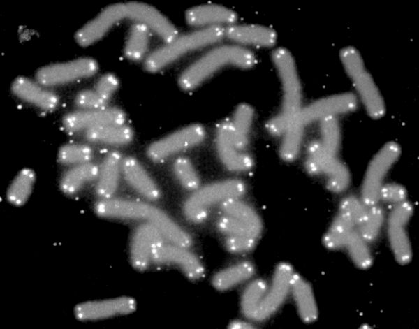 Human chromosomes (grey) capped by telomeres (white